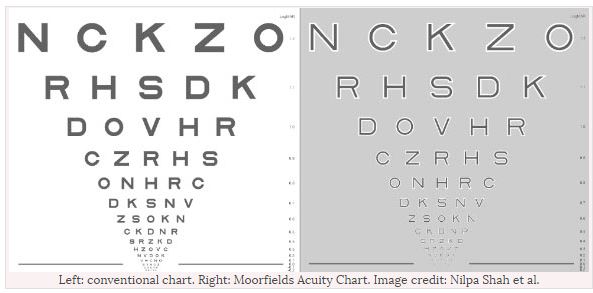 Macular Degeneration Eye Test Chart
